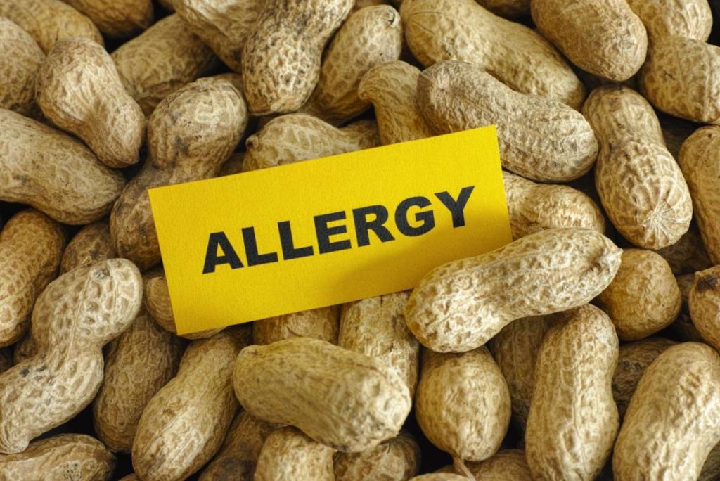 peanut-allergy
